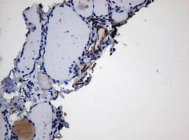 BTLA Antibody in Immunohistochemistry (Paraffin) (IHC (P))