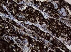 BTLA Antibody in Immunohistochemistry (Paraffin) (IHC (P))