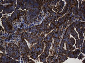 BTLA Antibody in Immunohistochemistry (Paraffin) (IHC (P))