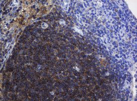 BTLA Antibody in Immunohistochemistry (Paraffin) (IHC (P))