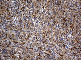 BTLA Antibody in Immunohistochemistry (Paraffin) (IHC (P))