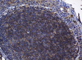 BTLA Antibody in Immunohistochemistry (Paraffin) (IHC (P))