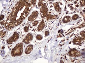 BTLA Antibody in Immunohistochemistry (Paraffin) (IHC (P))