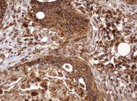 BTLA Antibody in Immunohistochemistry (Paraffin) (IHC (P))