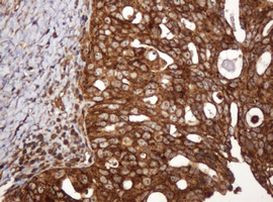 BTLA Antibody in Immunohistochemistry (Paraffin) (IHC (P))