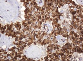 BTLA Antibody in Immunohistochemistry (Paraffin) (IHC (P))