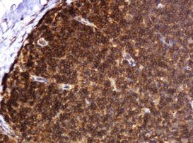 BTLA Antibody in Immunohistochemistry (Paraffin) (IHC (P))