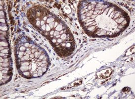 BTLA Antibody in Immunohistochemistry (Paraffin) (IHC (P))