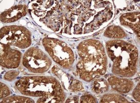 BTLA Antibody in Immunohistochemistry (Paraffin) (IHC (P))