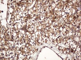 BTLA Antibody in Immunohistochemistry (Paraffin) (IHC (P))