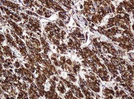 BTLA Antibody in Immunohistochemistry (Paraffin) (IHC (P))