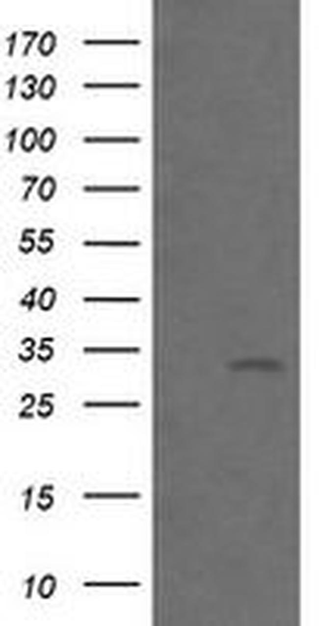 BTLA Antibody in Western Blot (WB)