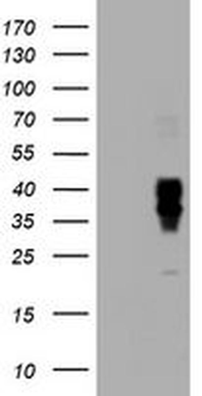 BTLA Antibody in Western Blot (WB)