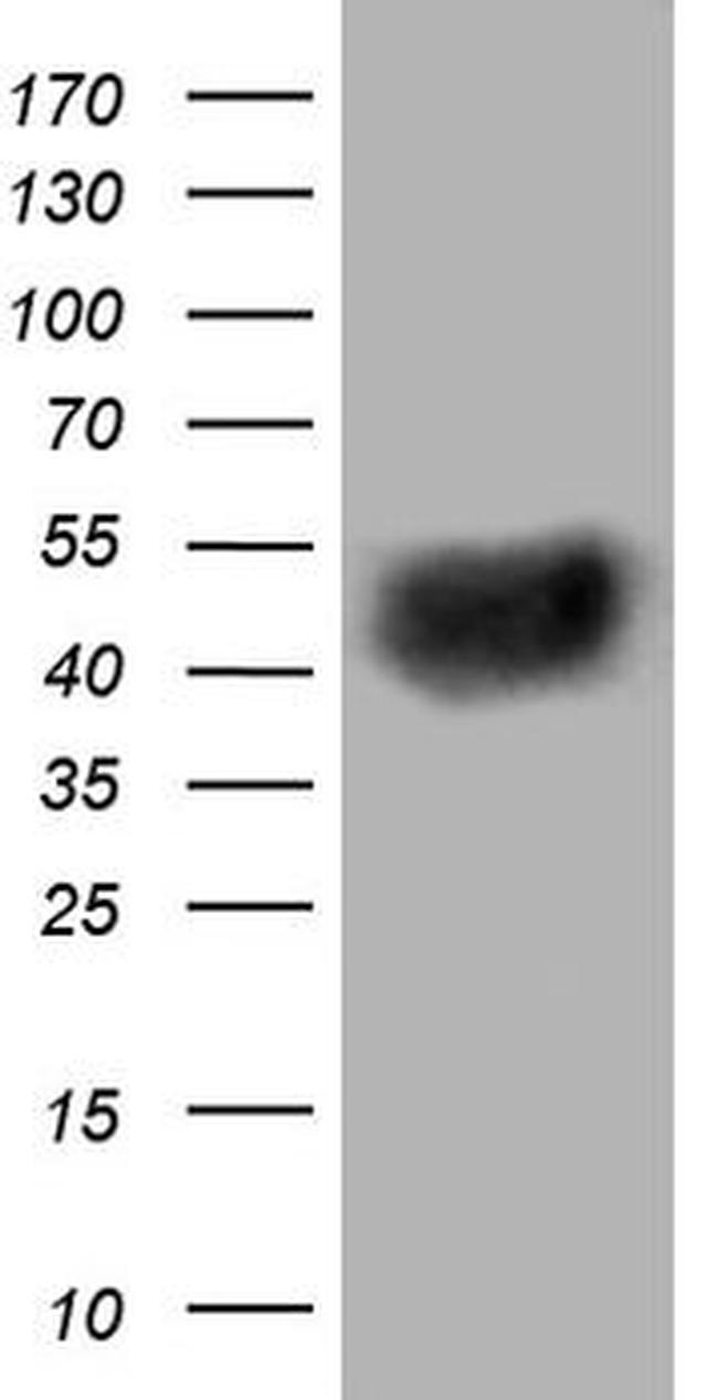 BTLA Antibody in Western Blot (WB)