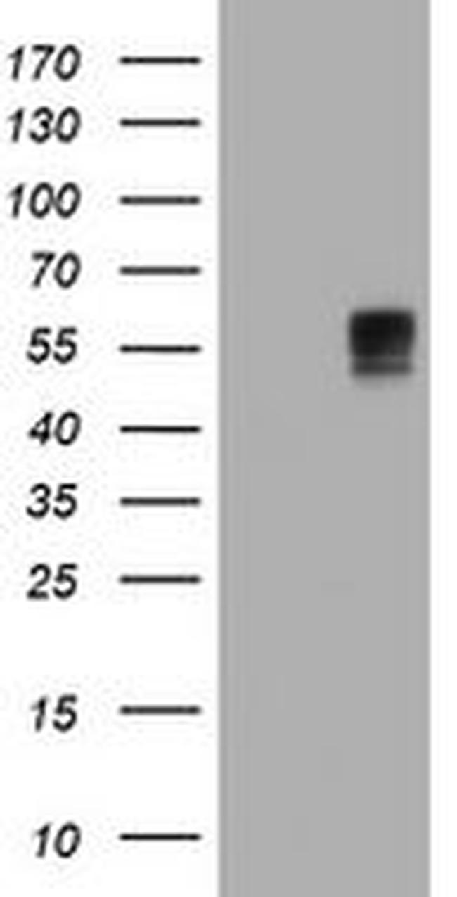 BTLA Antibody in Western Blot (WB)