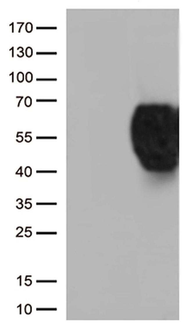 BTLA Antibody in Western Blot (WB)