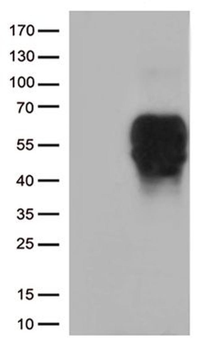 BTLA Antibody in Western Blot (WB)