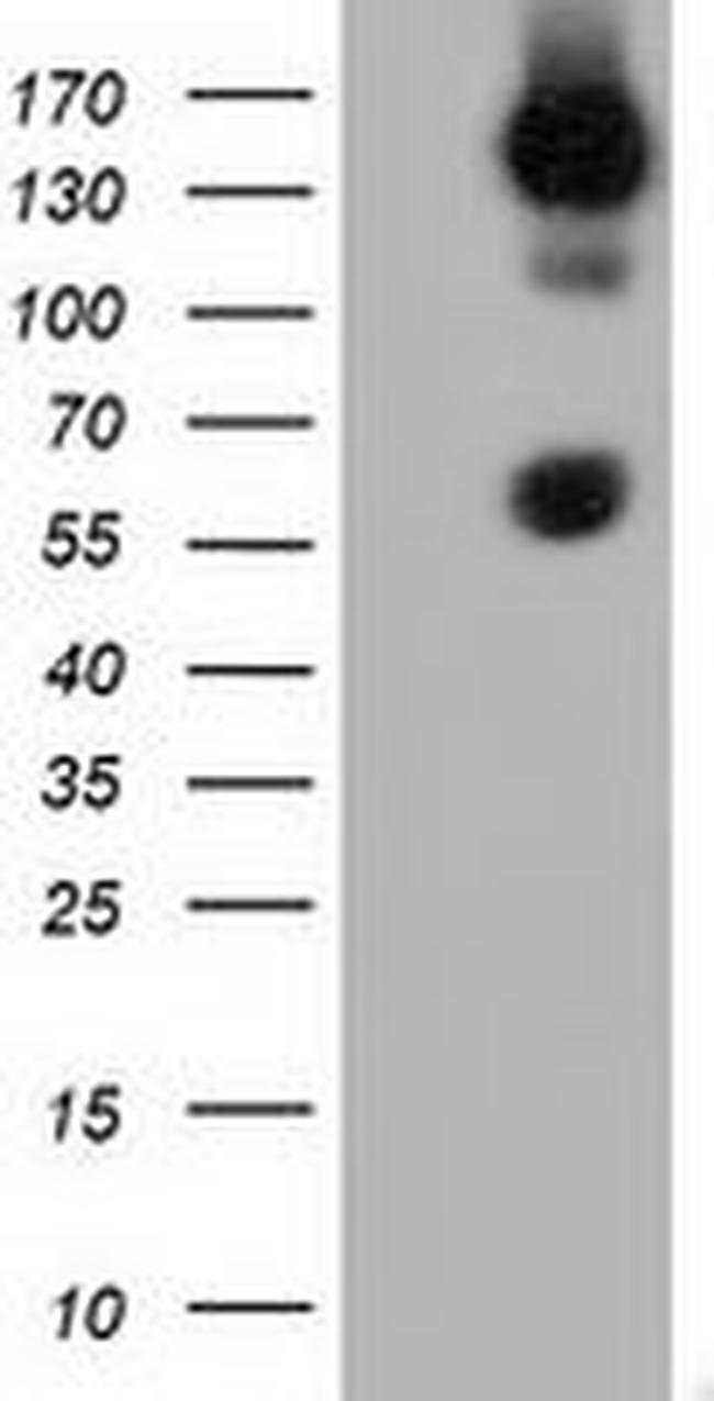 BTN1A1 Antibody in Western Blot (WB)