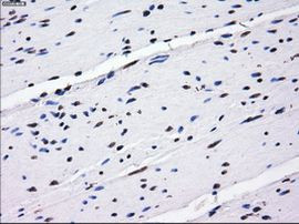 BTN3A2 Antibody in Immunohistochemistry (Paraffin) (IHC (P))