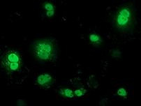 BTRC Antibody in Immunocytochemistry (ICC/IF)