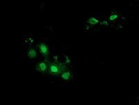 BTRC Antibody in Immunocytochemistry (ICC/IF)