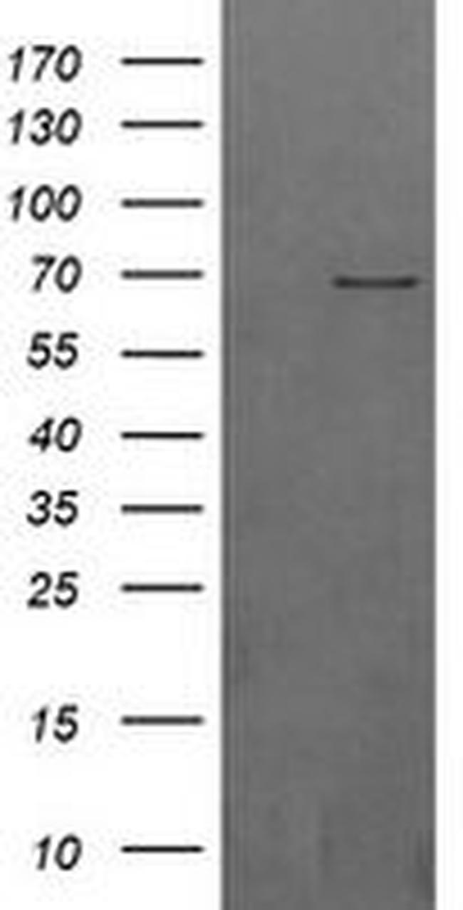 BTRC Antibody in Western Blot (WB)