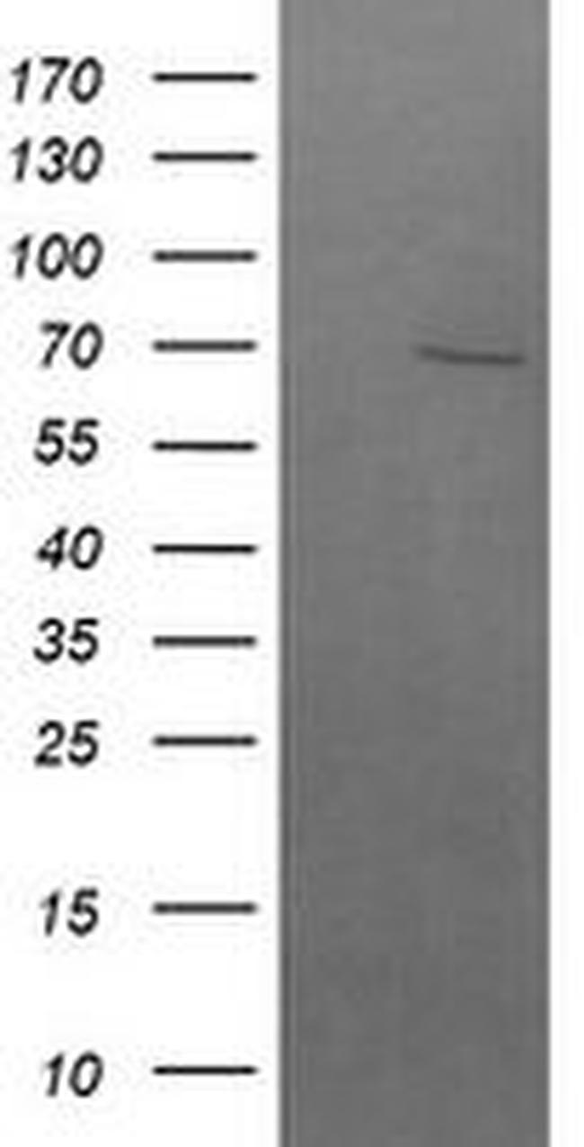 BTRC Antibody in Western Blot (WB)