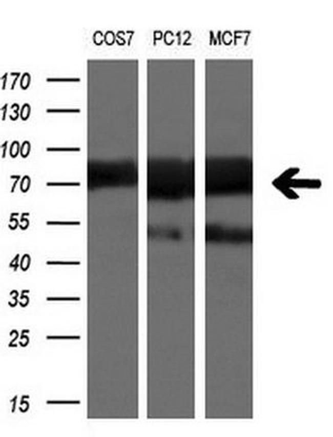 BTRC Antibody in Western Blot (WB)