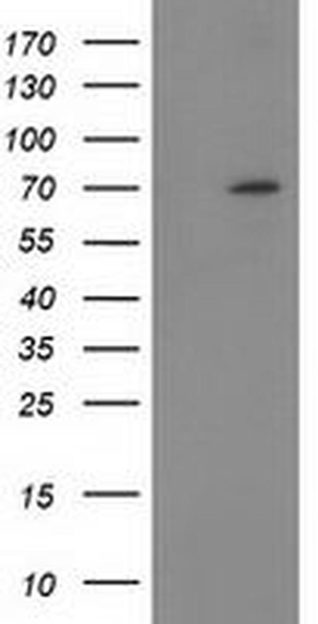 BTRC Antibody in Western Blot (WB)