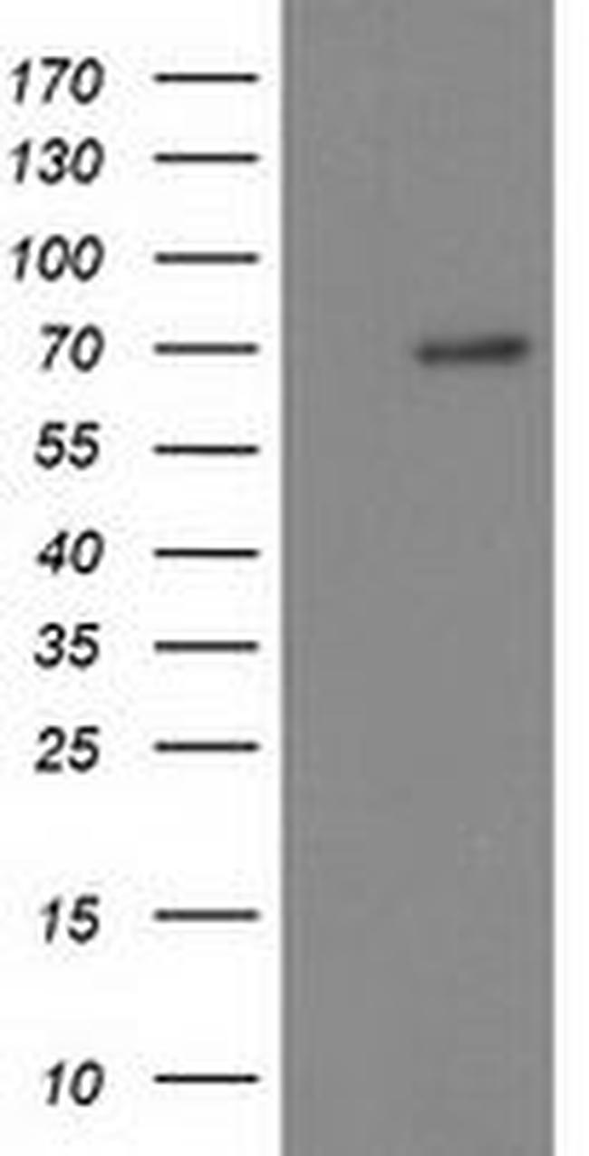 BTRC Antibody in Western Blot (WB)