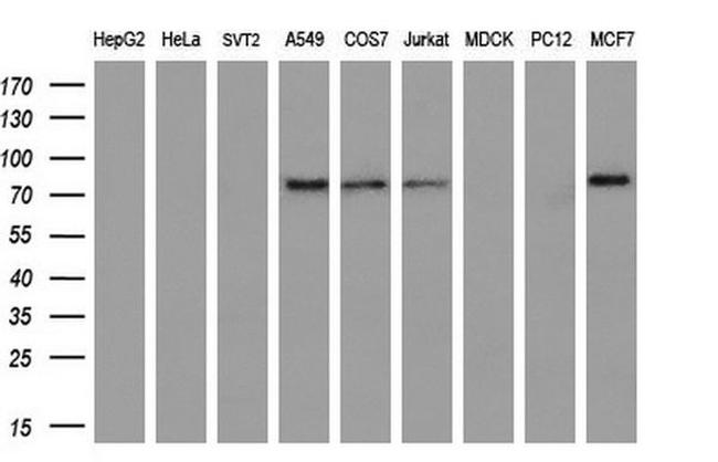 BTRC Antibody in Western Blot (WB)