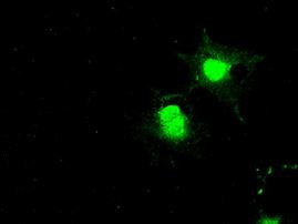 BUB1B Antibody in Immunocytochemistry (ICC/IF)