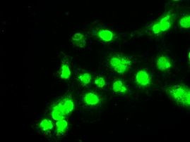 BUB1B Antibody in Immunocytochemistry (ICC/IF)