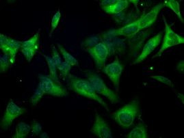 BUB1B Antibody in Immunocytochemistry (ICC/IF)