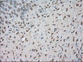 BUB1B Antibody in Immunohistochemistry (Paraffin) (IHC (P))