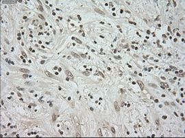 BUB1B Antibody in Immunohistochemistry (Paraffin) (IHC (P))