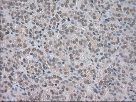 BUB1B Antibody in Immunohistochemistry (Paraffin) (IHC (P))