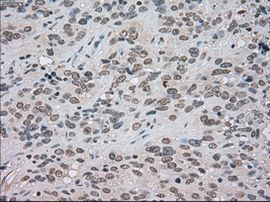 BUB1B Antibody in Immunohistochemistry (Paraffin) (IHC (P))