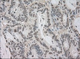 BUB1B Antibody in Immunohistochemistry (Paraffin) (IHC (P))