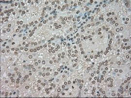 BUB1B Antibody in Immunohistochemistry (Paraffin) (IHC (P))