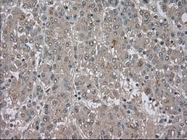 BUB1B Antibody in Immunohistochemistry (Paraffin) (IHC (P))