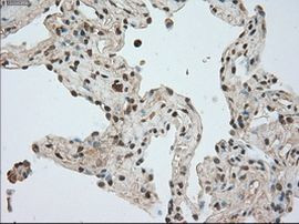 BUB1B Antibody in Immunohistochemistry (Paraffin) (IHC (P))