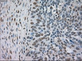 BUB1B Antibody in Immunohistochemistry (Paraffin) (IHC (P))