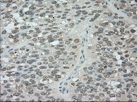 BUB1B Antibody in Immunohistochemistry (Paraffin) (IHC (P))