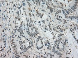 BUB1B Antibody in Immunohistochemistry (Paraffin) (IHC (P))