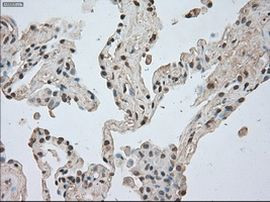 BUB1B Antibody in Immunohistochemistry (Paraffin) (IHC (P))