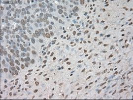 BUB1B Antibody in Immunohistochemistry (Paraffin) (IHC (P))