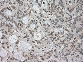 BUB1B Antibody in Immunohistochemistry (Paraffin) (IHC (P))