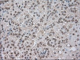 BUB1B Antibody in Immunohistochemistry (Paraffin) (IHC (P))