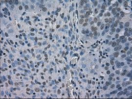 BUB1B Antibody in Immunohistochemistry (Paraffin) (IHC (P))